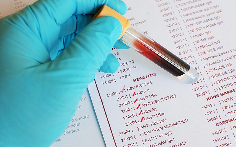 Xét nghiệm HBsAg nói lên điều gì? | Medlatec