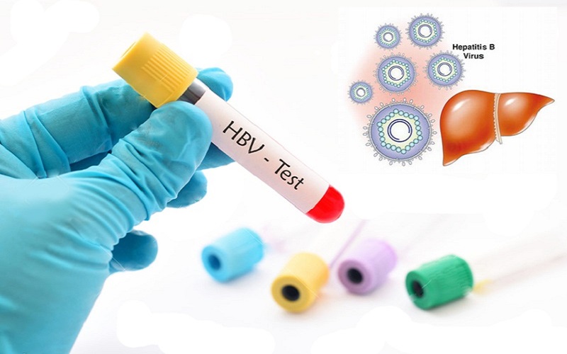 Kết quả xét nghiệm HBsAg như nào chứng tỏ bị viêm gan B? | Medlatec