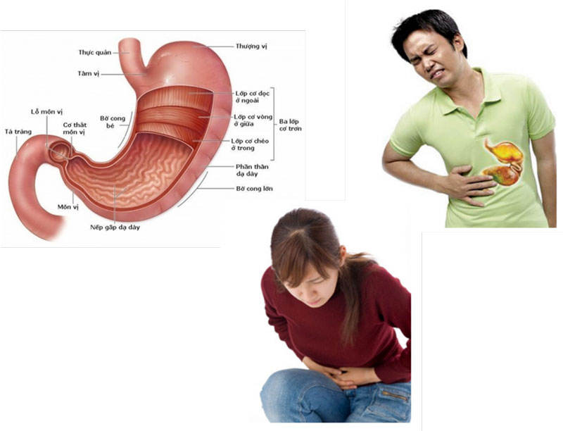 Viêm hang vị dạ dày: Nguyên nhân, triệu chứng và cách điều trị | Medlatec