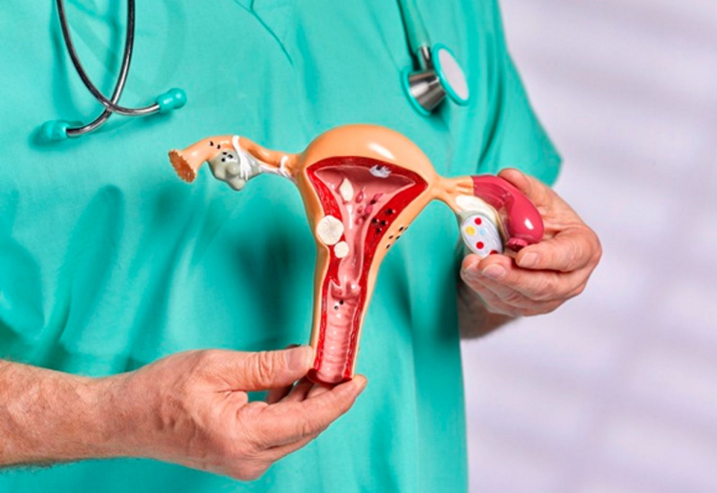 Điều trị lạc nội mạc tử cung có khó không? Khi nào cần phải phẫu thuật? | Medlatec