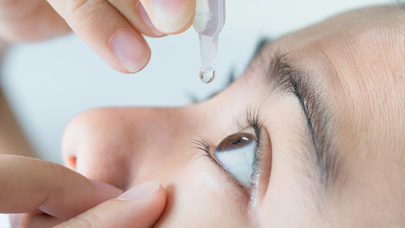 cách chữa ngứa mắt tại nhà