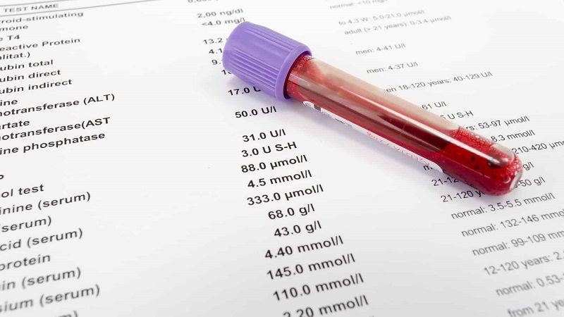 Xét nghiệm bilirubin là gì, có ý nghĩa ra sao | Medlatec