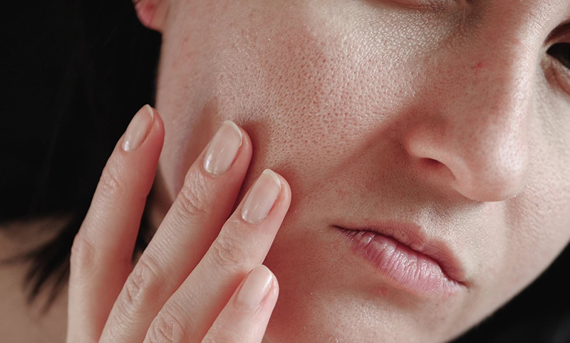 cách chữa khô da mặt
