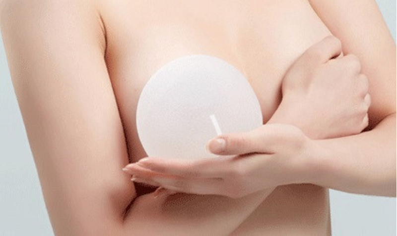 Liệu phẫu thuật nâng ngực có nguy hiểm không? | Medlatec