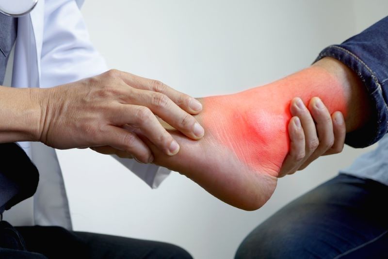 Cảnh giác gút - Bệnh “nhà giàu”, ngày càng gặp người trẻ tuổi mắc