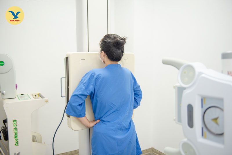 Chủ quan với khối u ở vú, người phụ nữ ngỡ ngàng phát hiện ung thư vú giai đoạn IIB