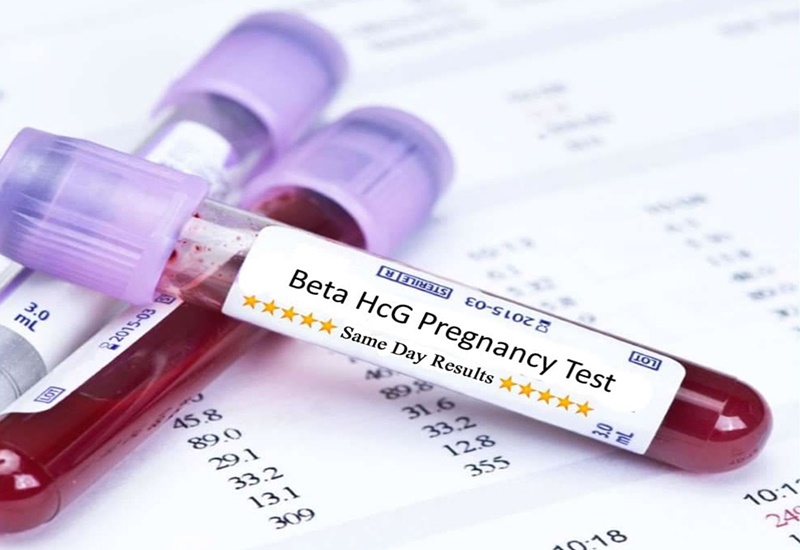 Xét nghiệm Beta tại nhà Bắc Ninh: Lựa chọn ngay MEDLATEC!